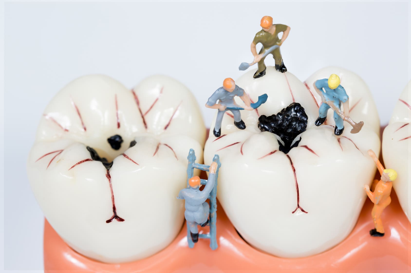 miniature people clean tooth model,medical concept