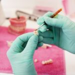 przygotowywanie protezy zębów